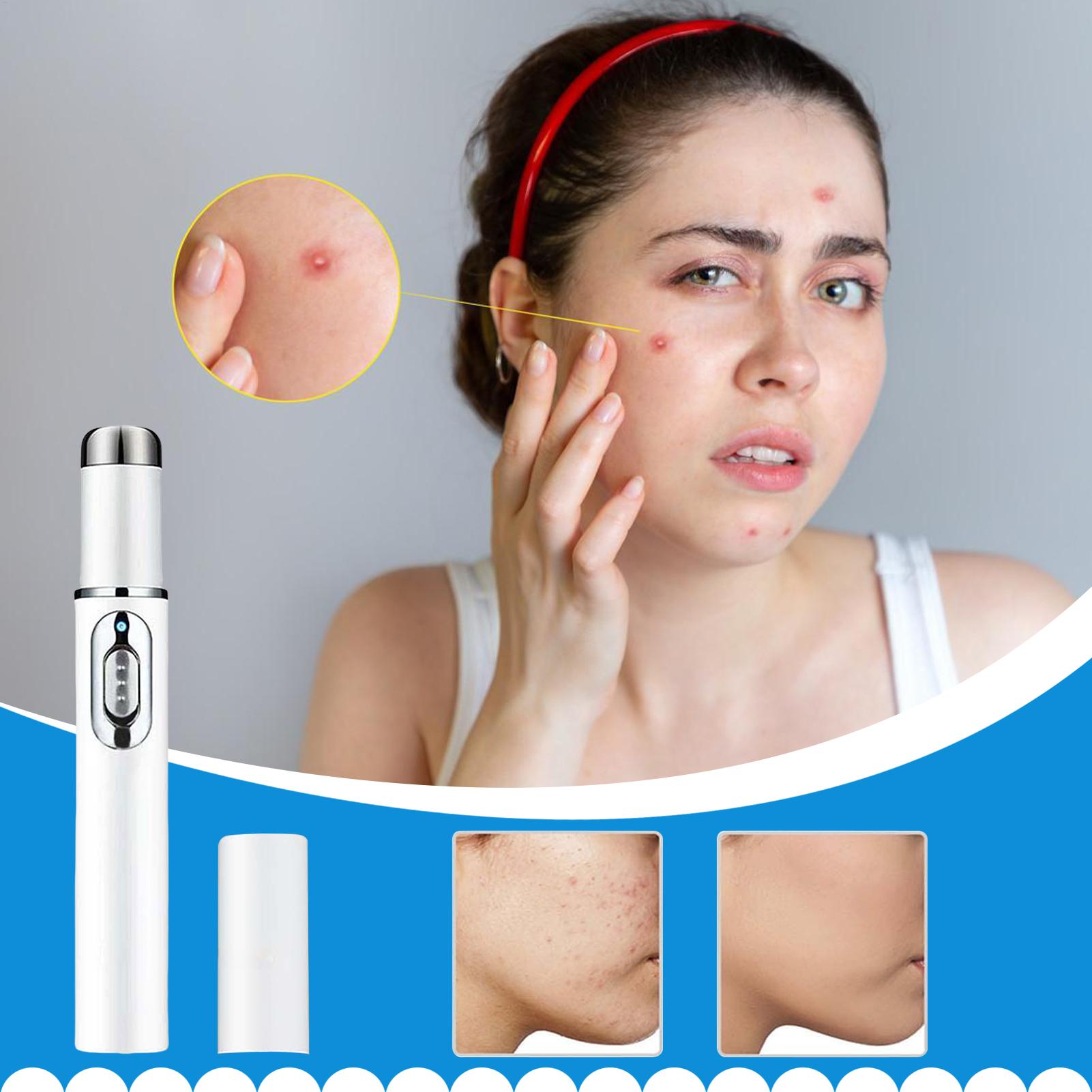 Stylo dissolvant de grains de  - Women Accessories Combo avis et prix